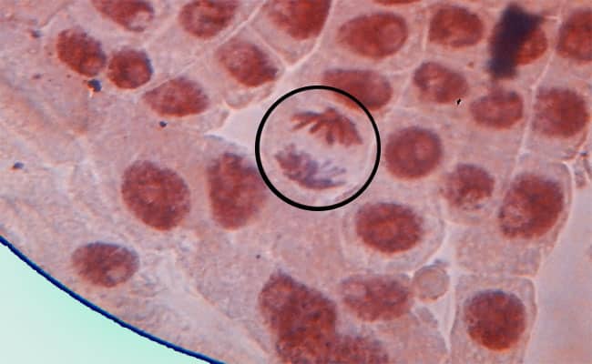 Ctocinesis1